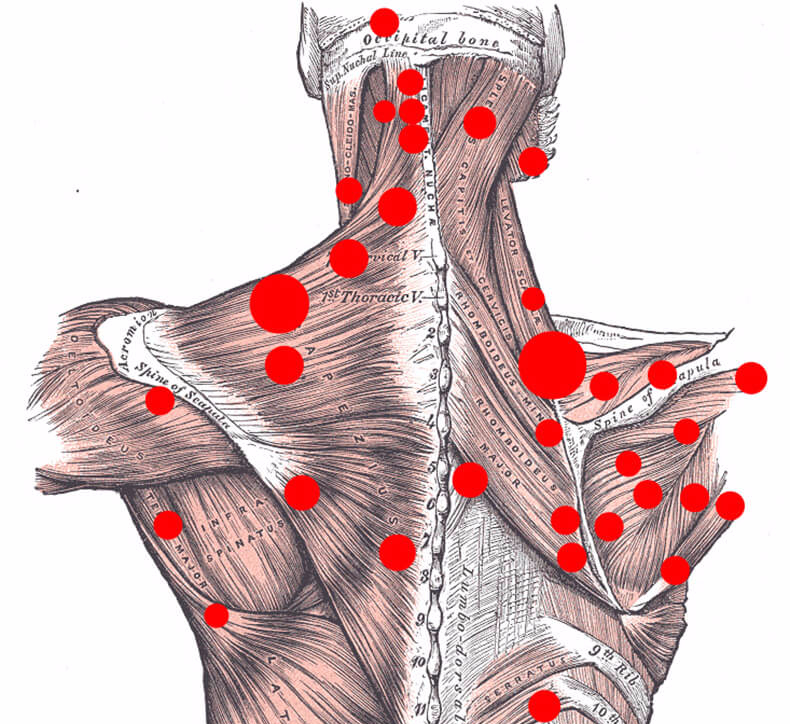 Trigger Point Development What is Trigger Point Therapy and How Does it Help Me??